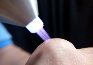 Điều trị vết thương sau mổ nhờ công nghệ Plasma