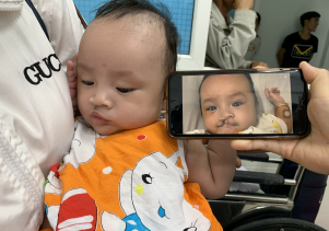 Tiếp nhận chuyển giao thành công kỹ thuật mổ sứt môi hở vòm từ Bệnh viện Răng Hàm Mặt Trung Ương
