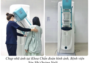 Chụp nhũ ảnh tầm soát Ung thư vú tại Bệnh viện Sản nhi tỉnh