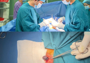 Liên tiếp tiếp nhận nhiều bệnh nhi bị Xoắn tinh hoàn.