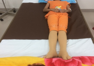 Hen phế quản nặng điều trị ổn định tại Khoa Hồi sức tích cực bệnh viện Sản - Nhi tỉnh Quảng Ngãi.
